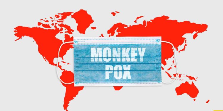 Ciri-ciri dan gejala penyakit cacar monyet