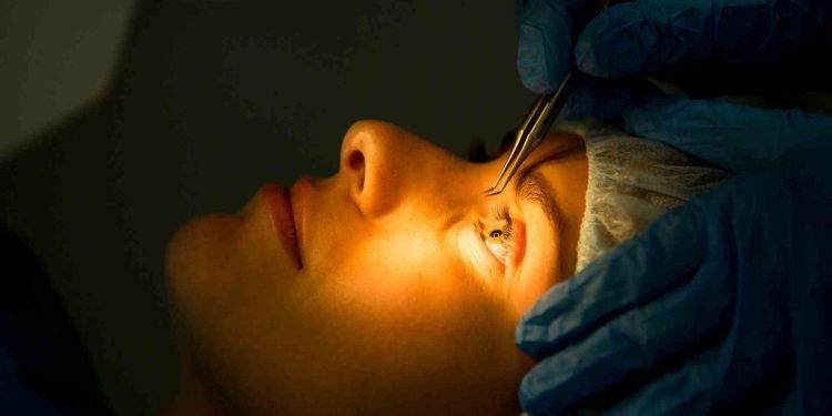 Operasi Lasik Mata Adalah