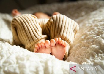 Kista Duktus Koledokus: Penyebab Bayi Lahir Kuning yang Perlu Diwaspadai