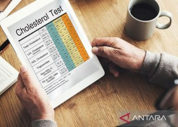 Rahasia Terbongkar: Cara Alami Mengatasi Kolesterol Tinggi