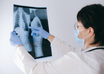 Waspada: Gejala Kanker Paru yang Tersembunyi dan Harus Diketahui untuk Deteksi Awal