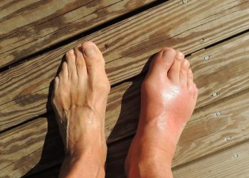 Daftar Sayuran Aman untuk Meredakan Gejala Asam Urat: Panduan Lengkap