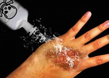 Ilustrasi Penyiraman Air Keras