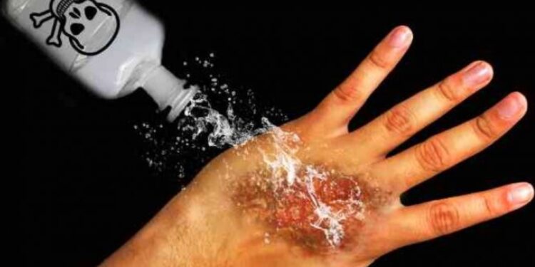 Ilustrasi Penyiraman Air Keras