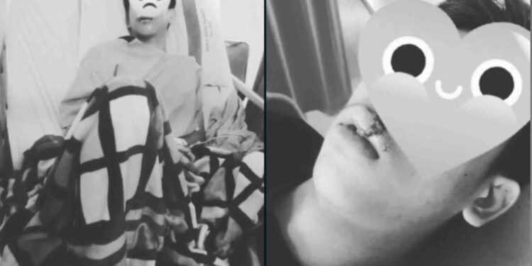 Korban Pelemparan batu di ringroad timur bantul