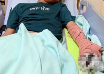 Seorang anak terluka Akibat Bermain Petasan di Sleman