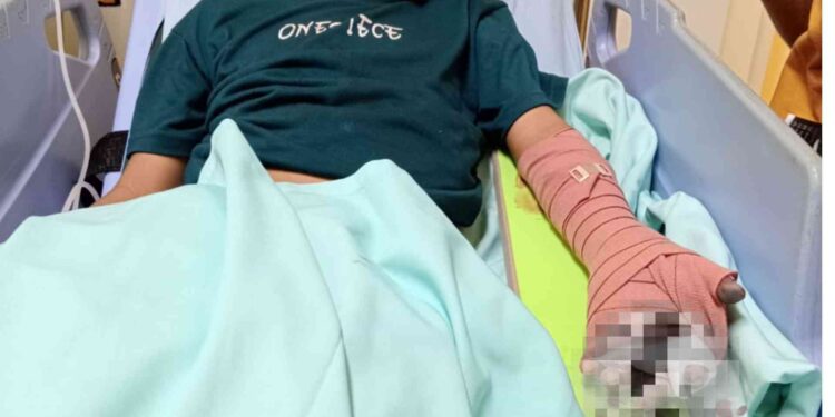 Seorang anak terluka Akibat Bermain Petasan di Sleman