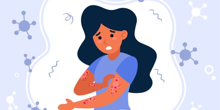 Guru Besar UGM Ungkap Metode Deteksi Dini Kusta di Indonesia