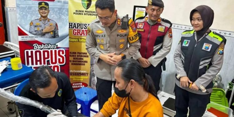 Polres Situbondo Adakan Program Hapus Tato Gratis dalam Rangka HUT ke-74 Korps Sabhara