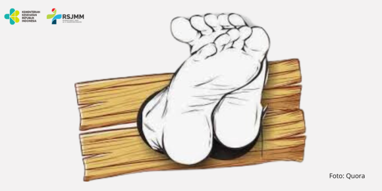 Pemerintah Dorong Penghapusan Praktik Pasung untuk ODGJ