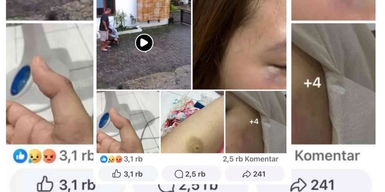 tangkapan layar Rekaman CCTV dan sejumlah foto yang beredar di media sosial memperlihatkan dugaan aksi penganiayaan terhadap seorang perempuan oleh kekasihnya