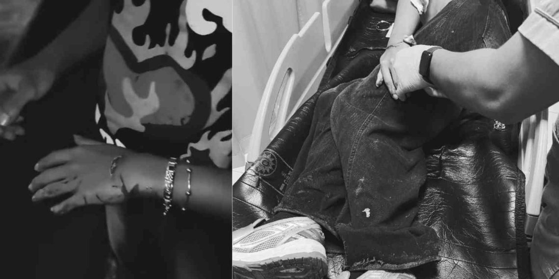 Korban dugaan aksi klitih di Godean Sleman saat mendapatkan penanganan medis. Ia mengalami luka di tangan kiri akibat sabetan senjata tajam dan menjalani perawatan di RS PKU Muhammadiyah Gamping sebelum diperbolehkan pulang.