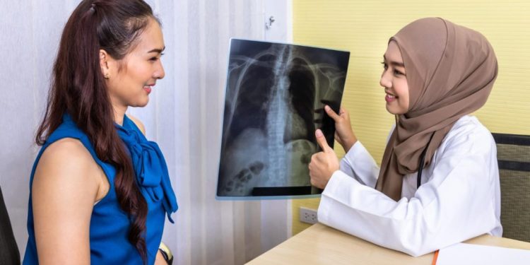 Kasus TBC di Indonesia Capai 1 Juta, Literasi Masyarakat Masih Rendah