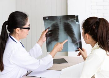 Angka Kematian TBC di Indonesia Capai 125 Ribu per Tahun, Masyarakat Diminta Waspada