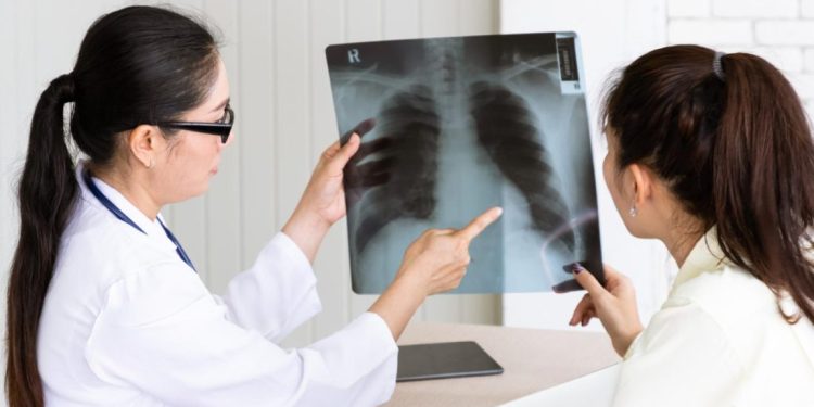 Angka Kematian TBC di Indonesia Capai 125 Ribu per Tahun, Masyarakat Diminta Waspada