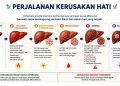 Pentingnya Deteksi Dini untuk Mencegah Kerusakan Hati