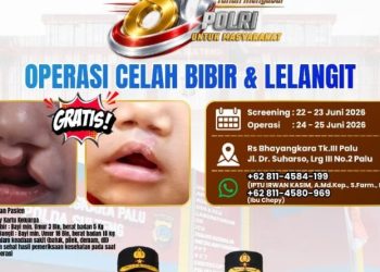 Polda Sulteng Adakan Operasi Gratis untuk Celah Bibir, Katarak, dan Pterygium