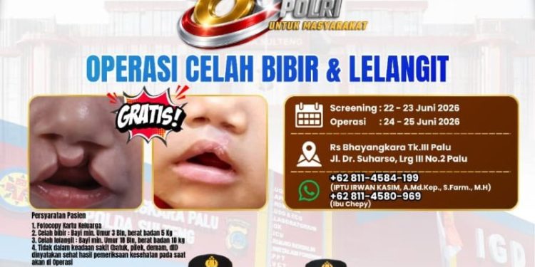 Polda Sulteng Adakan Operasi Gratis untuk Celah Bibir, Katarak, dan Pterygium