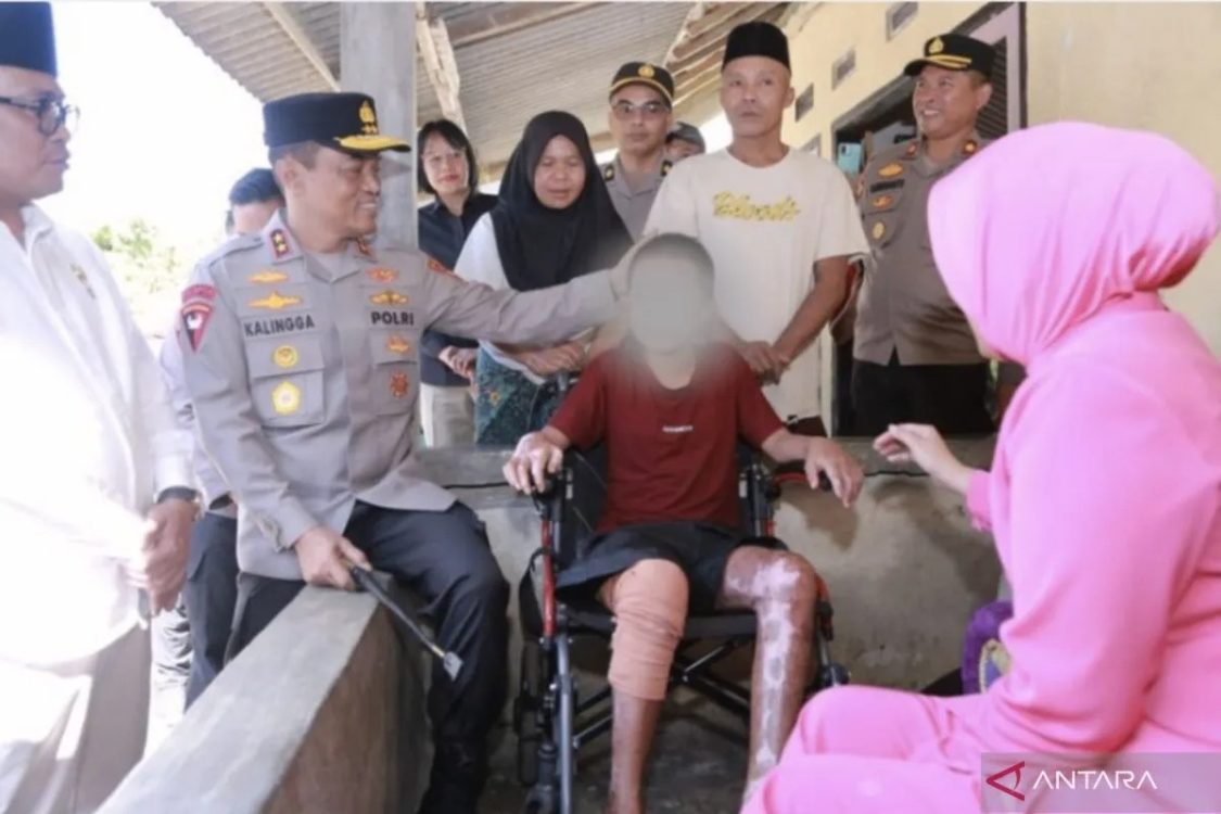 Kapolda NTB Tegaskan Proses Hukum Kasus Pembakaran Santri Berlanjut