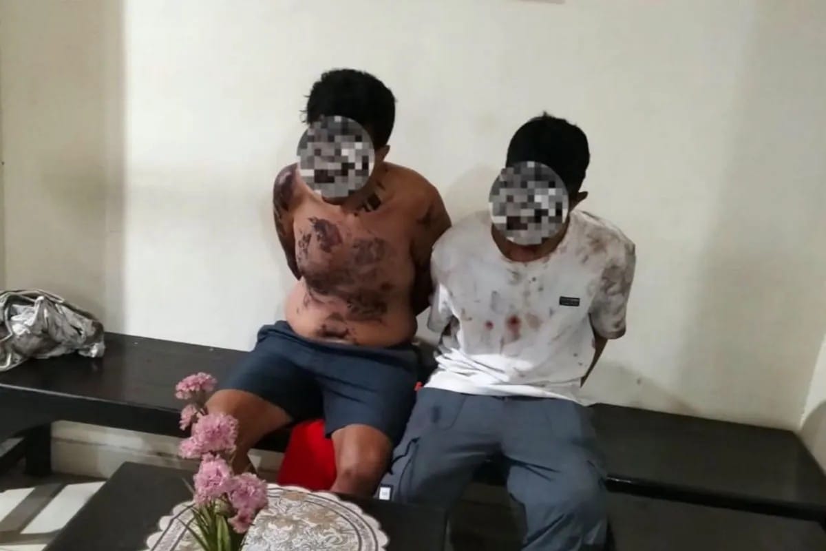 Polisi Tangkap Dua WNA Arab Saudi Terkait Penusukan Tiga Orang di Bali